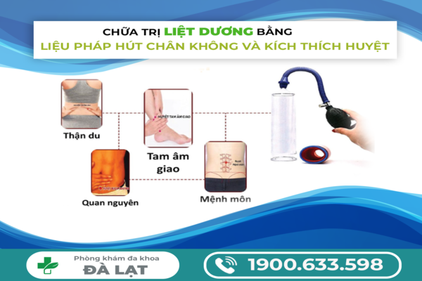 Hình ảnh minh họa